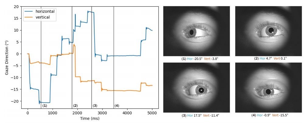 DiffEyeSyn: User-specific Subtle Eye Movement Synthesis Using Diffusion Models thumbnail